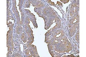 IHC analysis of MUC1 using anti-MUC1 antibody (ABIN7602711).