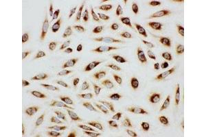 ICC testing of HeLa cells