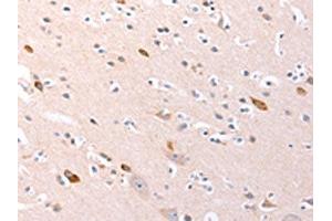 The image on the left is immunohistochemistry of paraffin-embedded Human brain tissue using ABIN7192139(RalA Antibody) at dilution 1/20, on the right is treated with synthetic peptide.