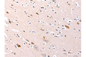 The image on the left is immunohistochemistry of paraffin-embedded Human brain tissue using ABIN7192139(RalA Antibody) at dilution 1/20, on the right is treated with synthetic peptide. (rala anticorps)