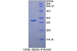 SDS-PAGE analysis of Rat B-Cell CLL/Lymphoma 3 Protein.