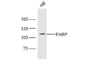 Human Raji lysates probed with Rabbit Anti-PARP1 Polyclonal Antibody, Unconjugated  at 1:5000 for 90 min at 37˚C.