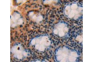 IHC-P analysis of rectum tissue, with DAB staining. (SBEM anticorps  (AA 21-90))