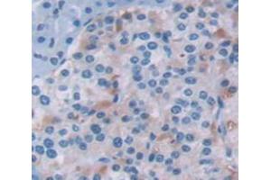 Figure. (LGALS9C anticorps  (AA 17-148))