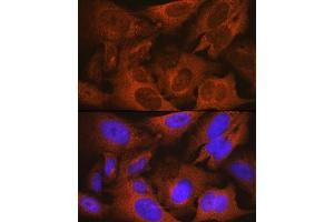 Immunofluorescence analysis of U-2 OS cells using MSMB Rabbit mAb (ABIN1681107, ABIN3018643, ABIN3018644 and ABIN7101636) at dilution of 1:100 (40x lens).
