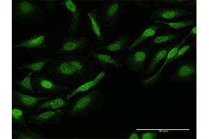 Immunofluorescence of purified MaxPab antibody to CRK on HeLa cell.