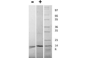 SDS-PAGE of Mouse Nerve Growth Factor beta Recombinant Protein SDS-PAGE of Mouse Nerve Growth Factor beta Recombinant Protein.