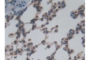 Detection of NME6 in Rat Lung Tissue using Polyclonal Antibody to Non Metastatic Cells 6, Protein Expressed In (NME6)