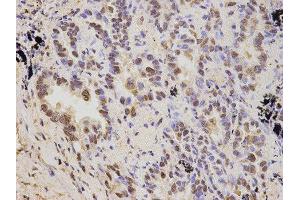 Immunohistochemistry (IHC) image for anti-Proteasome (Prosome, Macropain) 26S Subunit, Non-ATPase, 2 (PSMD2) antibody (ABIN1874389) (PSMD2 anticorps)