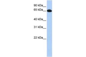 Western Blotting (WB) image for anti-Small Nuclear Ribonucleoprotein 70kDa (U1) (SNRNP70) antibody (ABIN2462137) (SNRNP70 anticorps)