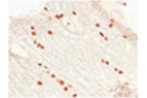 Sample Type:  Human Optic Nerve and Spinal CordCellular Target: Oligoden Drocyte Lineage Cells   Dilution:  1:500 (OLIG2 anticorps  (C-Term))