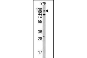 Western blot analysis of ABL1 Antibody (N-term ) (ABIN392079 and ABIN2841839) in Y79 cell line lysates (35 μg/lane).