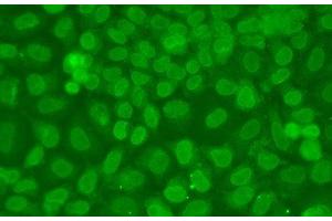 Immunofluorescence analysis of A549 cells using TARBP2 Polyclonal Antibody