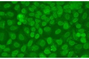 Immunofluorescence analysis of A549 cells using TARBP2 Polyclonal Antibody (TARBP2 anticorps)