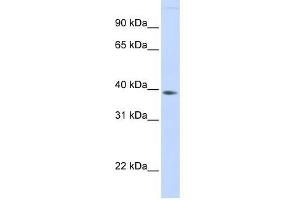 FAM76B antibody used at 1 ug/ml to detect target protein. (FAM76B anticorps  (Middle Region))