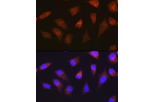 Immunofluorescence analysis of HeLa cells using PSM Rabbit mAb (ABIN7269597) at dilution of 1:100 (40x lens). (PSMA2 anticorps)