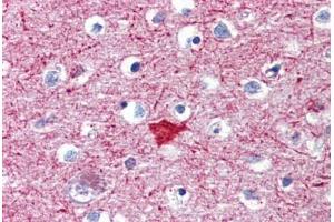 Human Brain, Cortex (formalin-fixed, paraffin-embedded) stained with MEF2C antibody ABIN462315 followed by biotinylated goat anti-rabbit IgG secondary antibody ABIN481713, alkaline phosphatase-streptavidin and chromogen.
