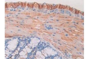 Detection of MAOA in Mouse Colon Tissue using Polyclonal Antibody to Monoamine Oxidase A (MAOA)