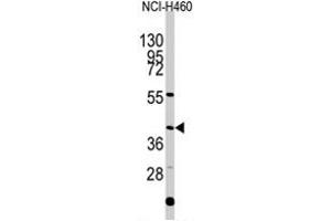 Western blot analysis of EN1 polyclonal antibody  in NCI-H460 cell line lysates (35 ug/lane). (EN1 anticorps  (N-Term))
