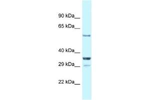 WB Suggested Anti-Cbll1 Antibody   Titration: 1. (CBLL1 anticorps  (C-Term))