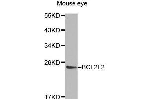 Western Blotting (WB) image for anti-BCL2-Like 2 (BCL2L2) (AA 1-193) antibody (ABIN3021581) (BCL2L2 anticorps  (AA 1-193))