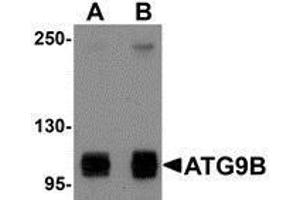 Western Blotting (WB) image for anti-Autophagy Related 9B (ATG9B) (C-Term) antibody (ABIN2477542) (ATG9B anticorps  (C-Term))