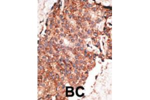 Immunohistochemistry (IHC) image for anti-Bone Morphogenetic Protein 1 (BMP1) antibody (ABIN2999234) (BMP1 anticorps)