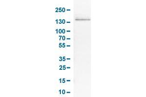 Western Blot analysis of RT-4 cell lysates with KIT monoclonal antibody, clone CL1667 . (KIT anticorps  (AA 50-190))