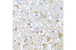 Immunohistochemistry of paraffin-embedded rat brain using EFHC1 antibody at dilution of 1:100 (x40 lens). (EFHC1 anticorps)