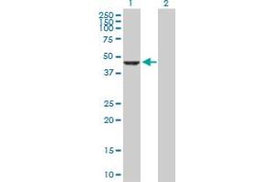 Western Blot analysis of CPA2 expression in transfected 293T cell line by CPA2 MaxPab polyclonal antibody. (Carboxypeptidase A2 anticorps  (AA 1-417))