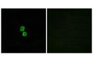 Immunofluorescence analysis of MCF-7 cells, using CKLF1 antibody. (CMTM1 anticorps)