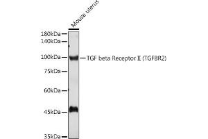 Western blot analysis of extracts of Mouse uterus, using TGF beta Receptor II (TGF beta Receptor II (TGFBR2)) antibody (ABIN6130735, ABIN6149085, ABIN6149088 and ABIN6215477) at 1:1000 dilution. (TGFBR2 anticorps  (AA 23-280))