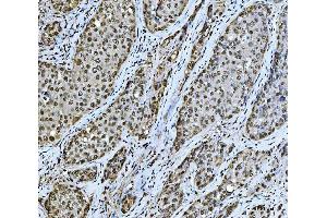 IHC analysis of PC4/SUB1 using anti-PC4/SUB1 antibody (ABIN7602184).