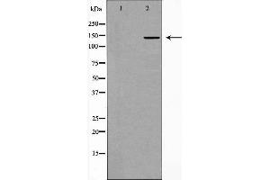 Western blot analysis of Collagen II expression in 3T3 cells. (COL2A1 anticorps  (N-Term))