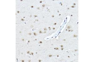 Immunohistochemistry of paraffin-embedded rat brain using Twist Rabbit pAb (ABIN6133951, ABIN6149713, ABIN6149716 and ABIN6220170) at dilution of 1:200 (40x lens). (TWIST1 anticorps  (AA 1-100))