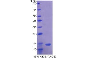 SDS-PAGE analysis of Human ACVR1B Protein.