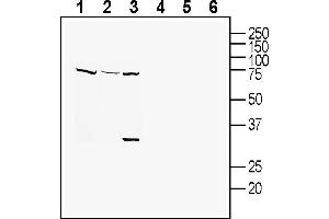 Western blot analysis of human  monocytic leukemia cell line lysates (lanes 1 and 4), human HUVEC endothelial cell line lysates (lanes 2 and 5) and mouse  microglia cell line lysate:1-3. (Tetraspanin 18 anticorps  (Extracellular))