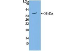 Detection of Recombinant SIRT6, Mouse using Polyclonal Antibody to Sirtuin 6 (SIRT6) (SIRT6 anticorps  (AA 1-334))