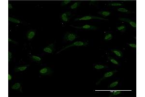 Immunofluorescence of monoclonal antibody to HNF1B on HeLa cell. (HNF1B anticorps  (AA 29-118))