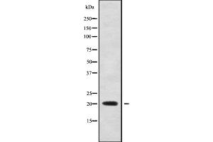Western blot analysis of TNFRSF17 using Jurkat whole cell lysates