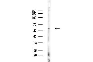 Western blot analysis of lysates from COLO205 cells(heat-shock,45 min treatment), using ARX Antibody at 1/1000 dilution.