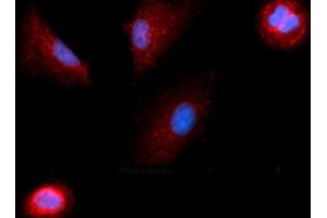 Immunofluorescence (IF) image for anti-Colony Stimulating Factor 1 (Macrophage) (CSF1) (AA 33-190) antibody (APC) (ABIN5568658)
