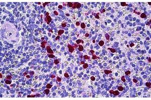 Human Spleen: Formalin-Fixed, Paraffin-Embedded (FFPE)