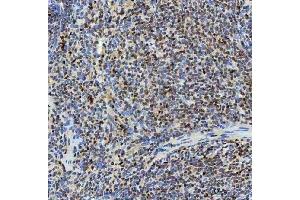 IHC analysis of SNRNP40 using anti-SNRNP40 antibody (ABIN7601719). (SNRNP40 anticorps  (AA 43-357))
