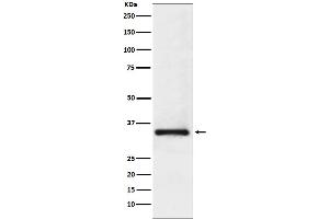 Western blot analysis of U1A expression in Jurkat cell lysate.
