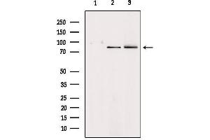 Western blot analysis of extracts from various samples, using HGF Antibody.