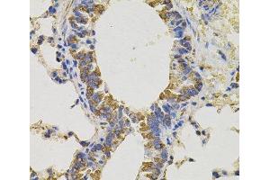 Immunohistochemistry of paraffin-embedded Mouse lung using PTPRC Polyclonal Antibody (CD45 anticorps)