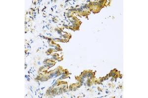 Immunohistochemistry of paraffin-embedded mouse lung using DEFB4A antibody at dilution of 1:100 (40x lens).