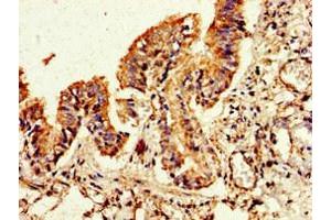 Immunohistochemistry of paraffin-embedded human lung tissue using ABIN7153171 at dilution of 1:100 (FLI1 anticorps  (AA 205-331))