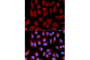 Immunofluorescence analysis of U2OS cell using TAP2 antibody. (TAP2 anticorps)